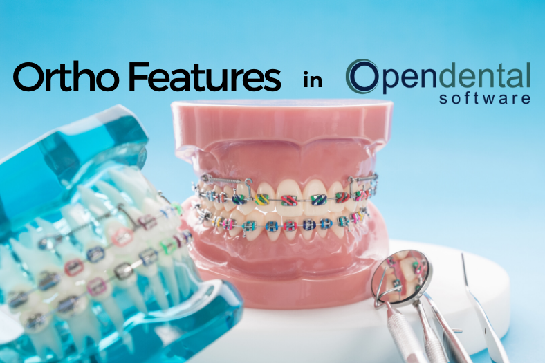 Ortho Features in Open Dental