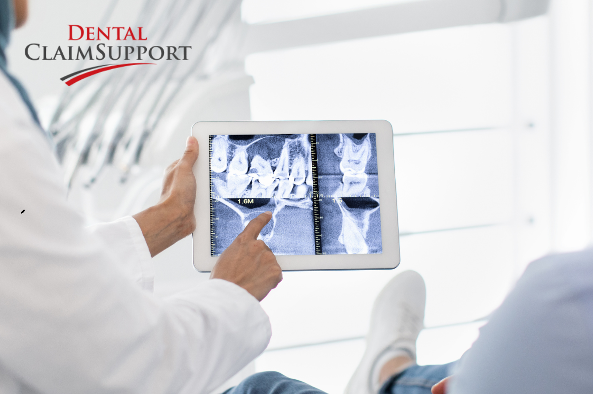 4 tips for successful oral surgery billing